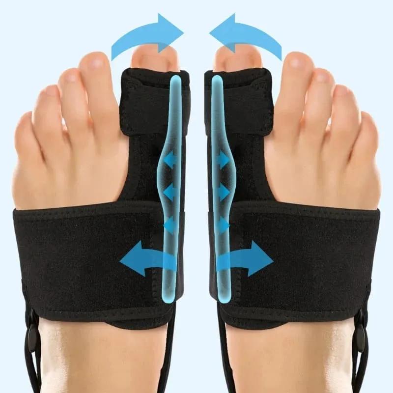 Klinische Untersuchung zu Korrektur-Orthesen bei Hallux valgus